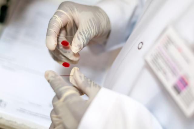 Nauènici korak bliže testu krvi za otkrivanje raka
